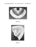 INTRA-ORAL LIGHT THERAPY APPARATUSES AND METHODS FOR THEIR USE diagram and image