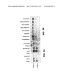 LAFORA S DISEASE GENE diagram and image