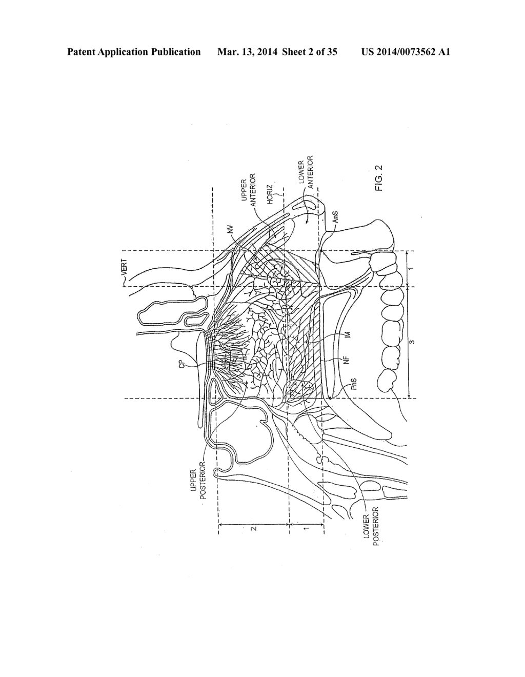 NASAL DELIVERY - diagram, schematic, and image 03