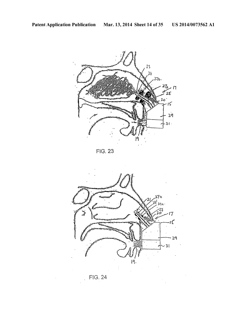 NASAL DELIVERY - diagram, schematic, and image 15