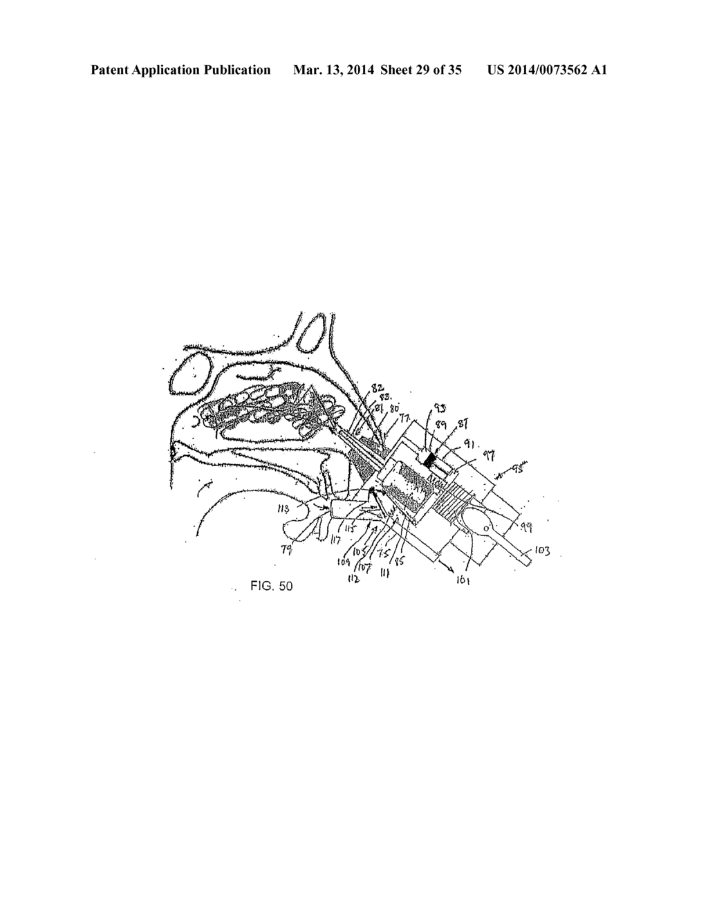 NASAL DELIVERY - diagram, schematic, and image 30