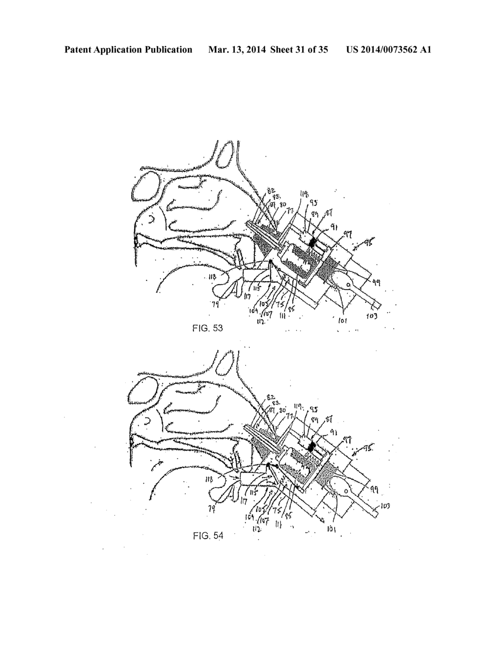 NASAL DELIVERY - diagram, schematic, and image 32