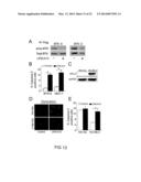 BRUTON S TYROSINE KINASE AS ANTI-CANCER DRUG TARGET diagram and image