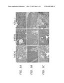 BLADDER CANCER TREATMENT AND METHODS diagram and image