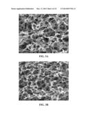 COLLAGEN SCAFFOLDS, MEDICAL IMPLANTS WITH SAME AND METHODS OF USE diagram and image