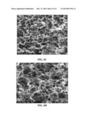 COLLAGEN SCAFFOLDS, MEDICAL IMPLANTS WITH SAME AND METHODS OF USE diagram and image