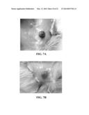 COLLAGEN SCAFFOLDS, MEDICAL IMPLANTS WITH SAME AND METHODS OF USE diagram and image