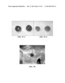 COLLAGEN SCAFFOLDS, MEDICAL IMPLANTS WITH SAME AND METHODS OF USE diagram and image