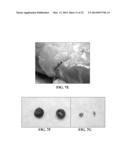 COLLAGEN SCAFFOLDS, MEDICAL IMPLANTS WITH SAME AND METHODS OF USE diagram and image