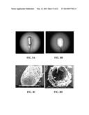 COLLAGEN SCAFFOLDS, MEDICAL IMPLANTS WITH SAME AND METHODS OF USE diagram and image