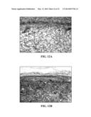 COLLAGEN SCAFFOLDS, MEDICAL IMPLANTS WITH SAME AND METHODS OF USE diagram and image