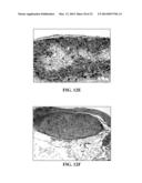 COLLAGEN SCAFFOLDS, MEDICAL IMPLANTS WITH SAME AND METHODS OF USE diagram and image