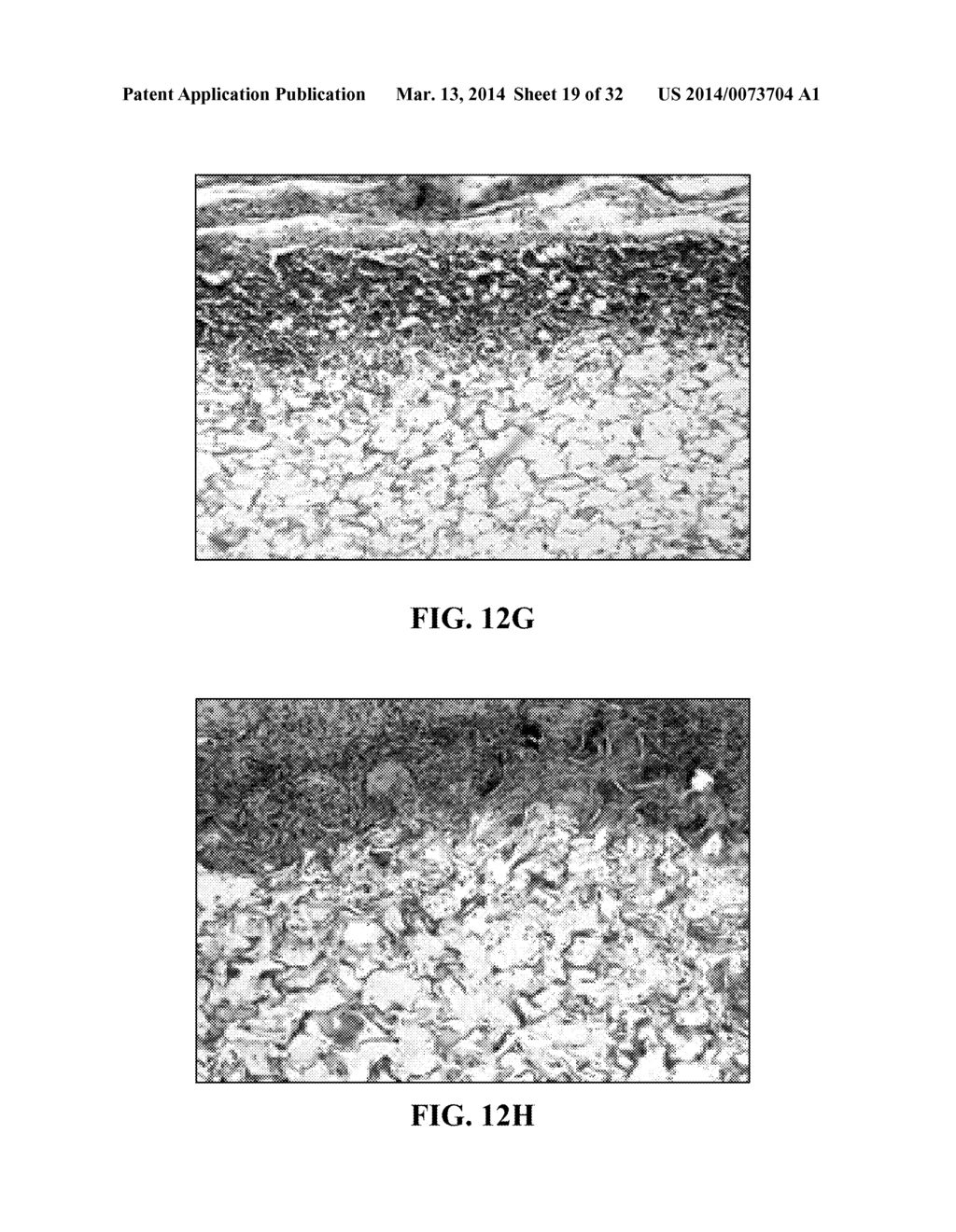 COLLAGEN SCAFFOLDS, MEDICAL IMPLANTS WITH SAME AND METHODS OF USE - diagram, schematic, and image 20