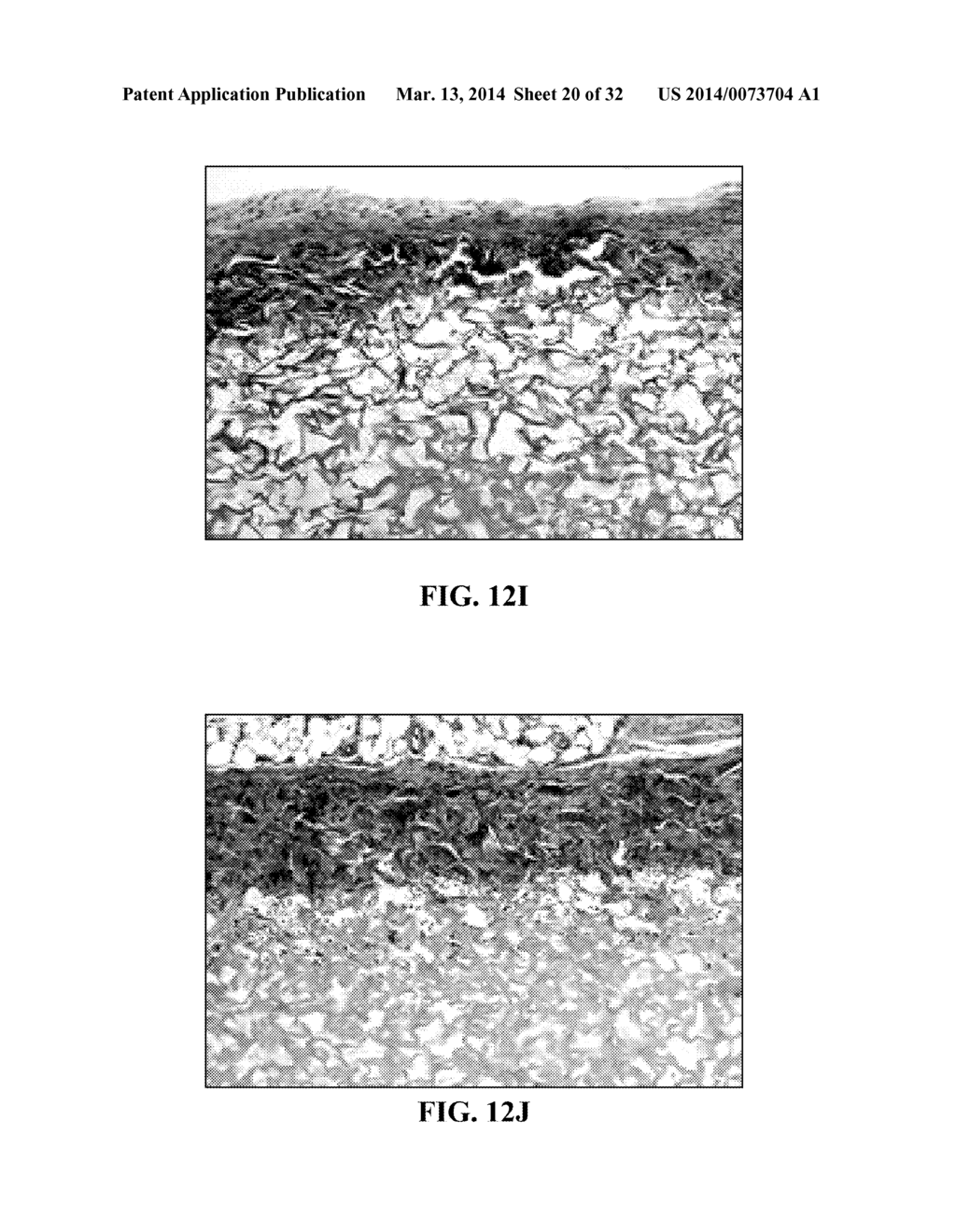 COLLAGEN SCAFFOLDS, MEDICAL IMPLANTS WITH SAME AND METHODS OF USE - diagram, schematic, and image 21