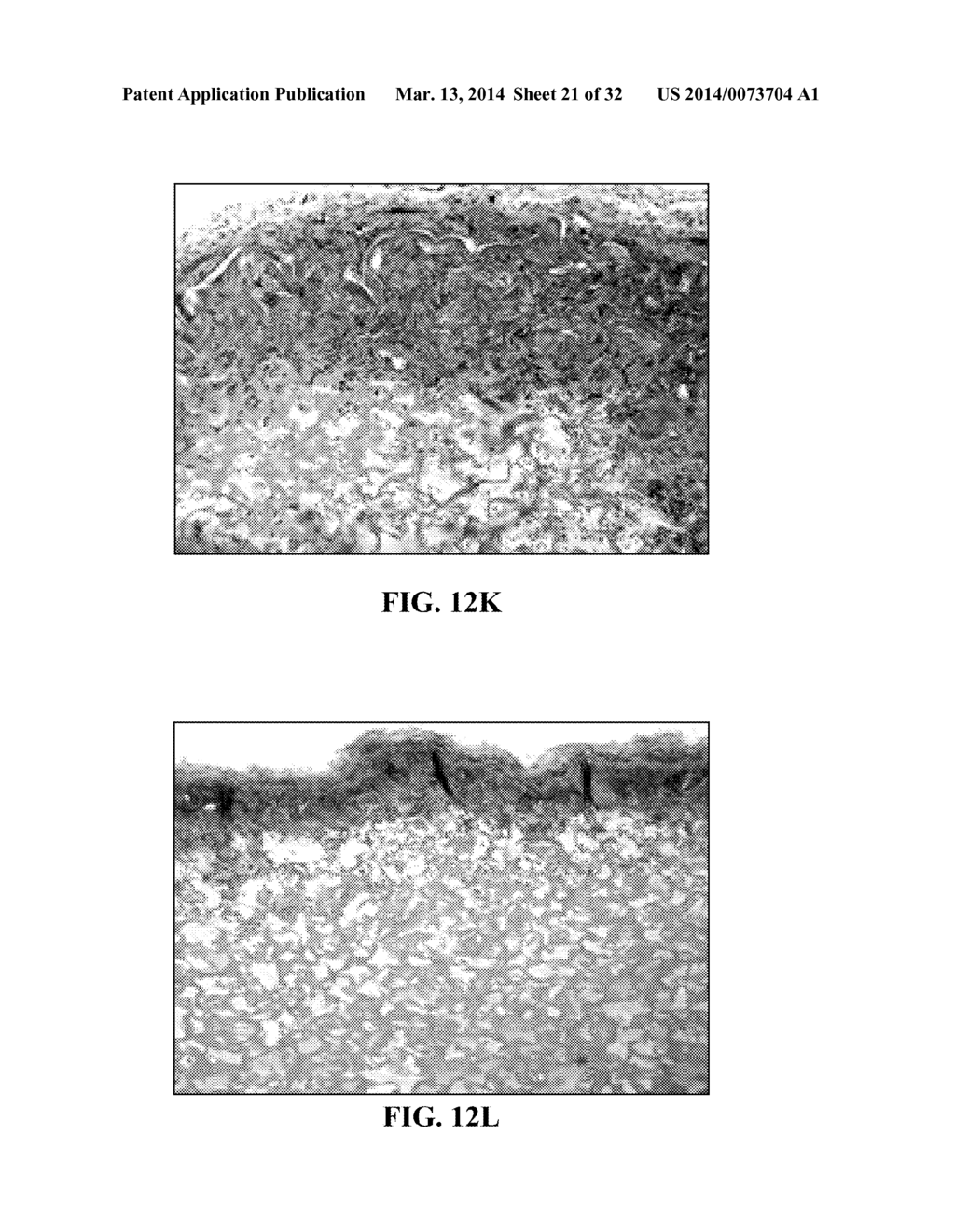 COLLAGEN SCAFFOLDS, MEDICAL IMPLANTS WITH SAME AND METHODS OF USE - diagram, schematic, and image 22