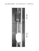 COLLAGEN SCAFFOLDS, MEDICAL IMPLANTS WITH SAME AND METHODS OF USE diagram and image