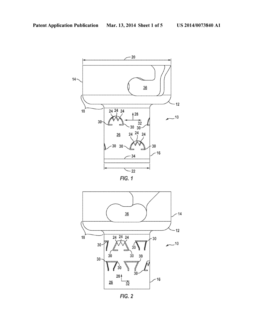 Implantable Receptacle for a Hearing Aid Component - diagram, schematic, and image 02