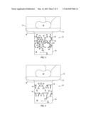 Implantable Receptacle for a Hearing Aid Component diagram and image