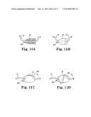 IMPLANTS, TOOLS, AND METHODS FOR TREATMENT OF PELVIC CONDITIONS diagram and image