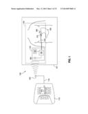 REMOTELY POWERED REMOTELY ADJUSTABLE GASTRIC BAND SYSTEM diagram and image