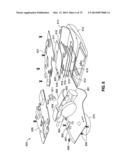 REMOTELY POWERED REMOTELY ADJUSTABLE GASTRIC BAND SYSTEM diagram and image