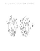 REMOTELY POWERED REMOTELY ADJUSTABLE GASTRIC BAND SYSTEM diagram and image