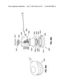 REMOTELY POWERED REMOTELY ADJUSTABLE GASTRIC BAND SYSTEM diagram and image