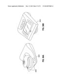 REMOTELY POWERED REMOTELY ADJUSTABLE GASTRIC BAND SYSTEM diagram and image