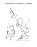 REMOTELY POWERED REMOTELY ADJUSTABLE GASTRIC BAND SYSTEM diagram and image