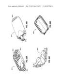 REMOTELY POWERED REMOTELY ADJUSTABLE GASTRIC BAND SYSTEM diagram and image