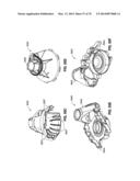 REMOTELY POWERED REMOTELY ADJUSTABLE GASTRIC BAND SYSTEM diagram and image