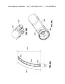 REMOTELY POWERED REMOTELY ADJUSTABLE GASTRIC BAND SYSTEM diagram and image