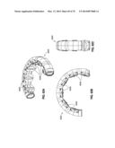 REMOTELY POWERED REMOTELY ADJUSTABLE GASTRIC BAND SYSTEM diagram and image