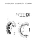 REMOTELY POWERED REMOTELY ADJUSTABLE GASTRIC BAND SYSTEM diagram and image