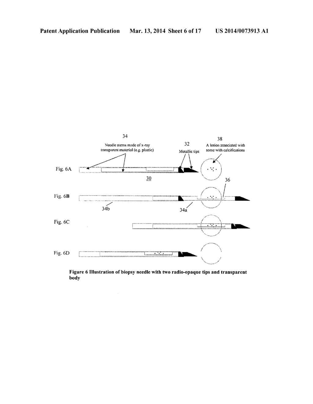 BREAST BIOPSY AND NEEDLE LOCALIZATION USING TOMOSYNTHESIS SYSTEMS - diagram, schematic, and image 07