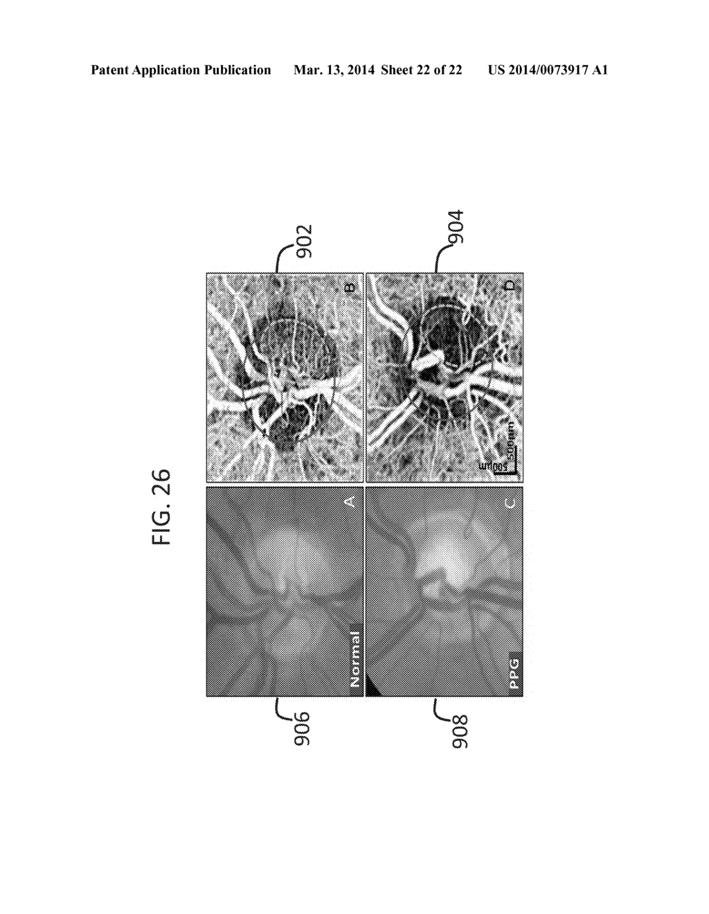 QUANTIFICATION OF LOCAL CIRCULATION WITH OCT ANGIOGRAPHY - diagram, schematic, and image 23