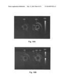 SYSTEMS AND METHODS FOR MAKING AND USING ROTATIONAL TRANSDUCERS FOR     CONCURRENTLY IMAGING BLOOD FLOW AND TISSUE diagram and image