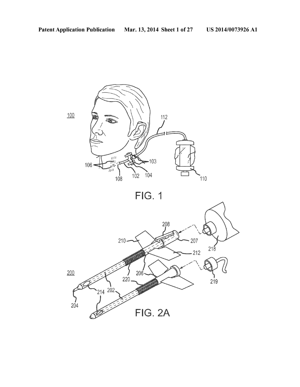 CONTINUOUS ANESTHESIA NERVE CONDUCTION APPARATUS AND METHOD - diagram, schematic, and image 02