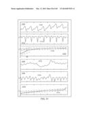 METHODS AND SYSTEMS FOR CONDITIONING PHYSIOLOGICAL INFORMATION USING A     NORMALIZATION TECHNIQUE diagram and image