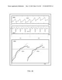 METHODS AND SYSTEMS FOR CONDITIONING PHYSIOLOGICAL INFORMATION USING A     NORMALIZATION TECHNIQUE diagram and image