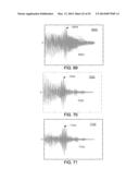 METHODS AND SYSTEMS FOR DETERMINING PHYSIOLOGICAL INFORMATION BASED ON     FAILURE INFORMATION diagram and image