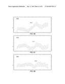 METHODS AND SYSTEMS FOR DETERMINING PHYSIOLOGICAL INFORMATION BASED ON A     CROSS-CORRELATION WAVEFORM diagram and image