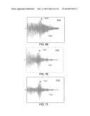 METHODS AND SYSTEMS FOR DETERMINING PHYSIOLOGICAL INFORMATION BASED ON A     CROSS-CORRELATION WAVEFORM diagram and image