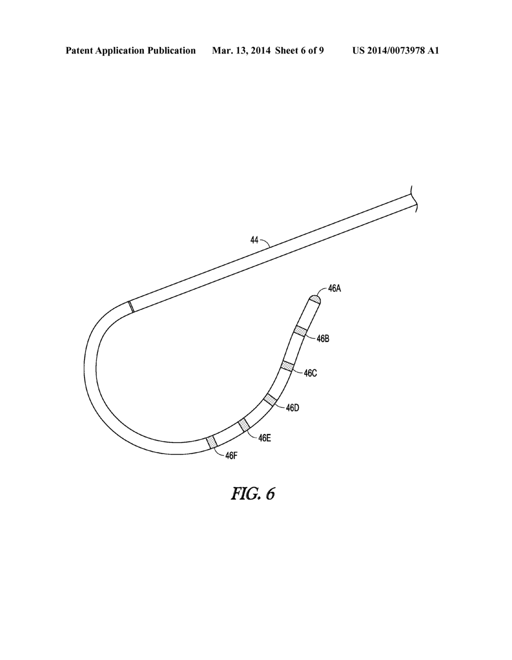 METHOD AND APPARATUS FOR SENSING AND AVOIDING CARDIAC CONDUCTION SYSTEM     DURING VALVE DEPLOYMENT - diagram, schematic, and image 07