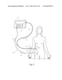 STIMULATION DEVICE ADAPTER diagram and image