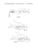 STIMULATION DEVICE ADAPTER diagram and image