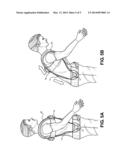 Posture and Lifting Orthotic diagram and image