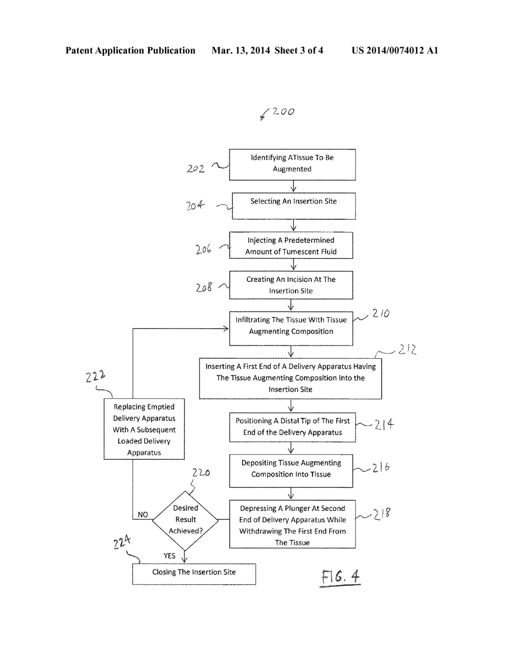 COMPOSITION, SYSTEM AND METHOD FOR TISSUE AUGMENTATION - diagram, schematic, and image 04