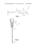 One-Piece Molded Catheter and Method of Manufacture diagram and image