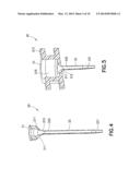 One-Piece Molded Catheter and Method of Manufacture diagram and image